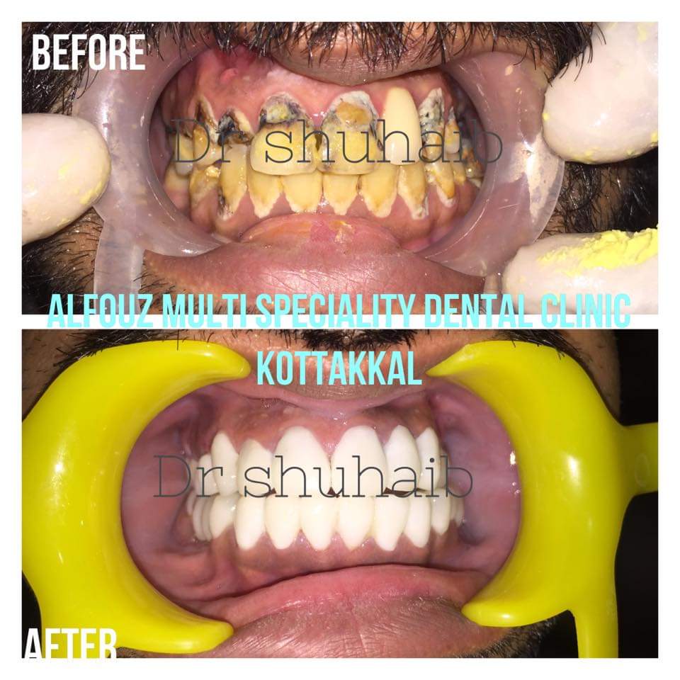 AL FOUZ MULTI SPECIALITY DENTAL CLINIC KOTTAKKAL
