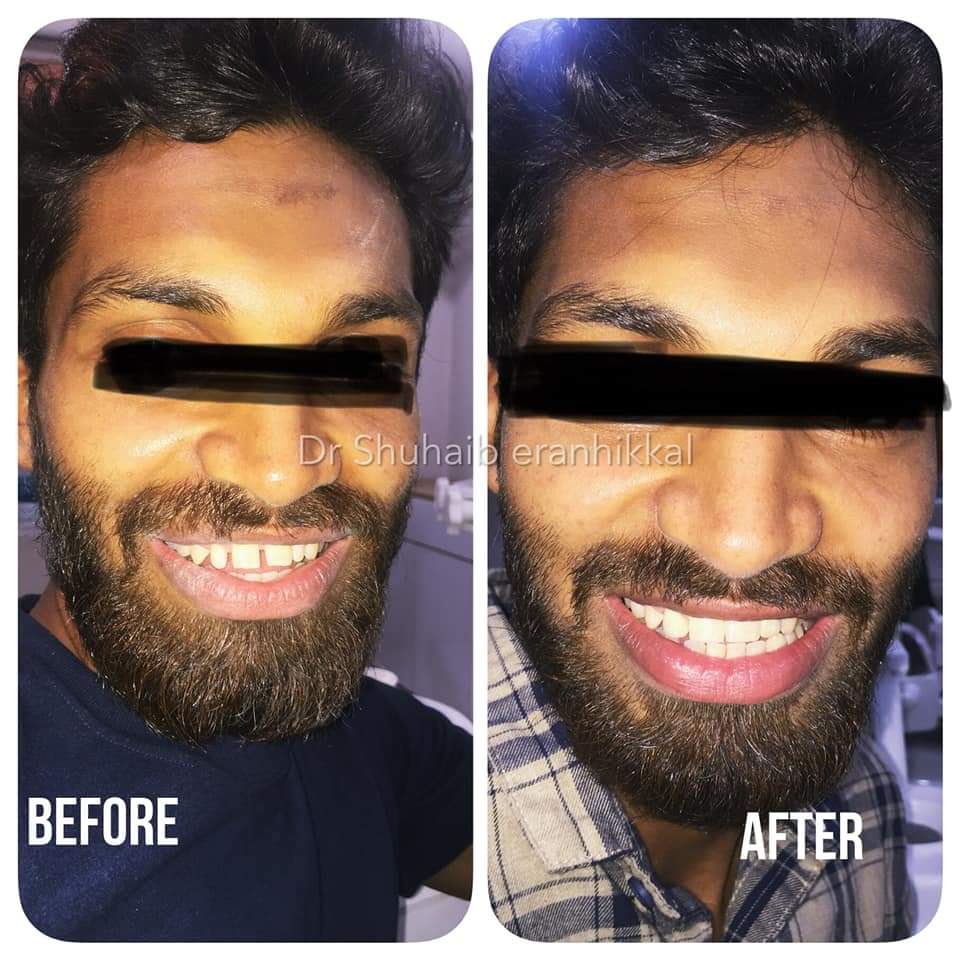 AL FOUZ MULTI SPECIALITY DENTAL CLINIC KOTTAKKAL